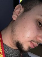 Minoxidil Member's Mark 5%, 1 Luna Aplicare, Tratament pentru caderea parului si cresterea barbii, 60 ml - imagine 2