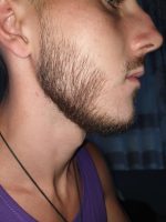 Minoxidil Dualgen 5% Absorbtie Rapida, fara PG, 1 Luna Aplicare, Tratament pentru caderea parului si cresterea barbii - imagine 11