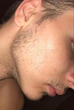 Minoxidil Rogaine 5%, 1 Luna Aplicare, Tratament pentru caderea parului si cresterea barbii - imagine 3