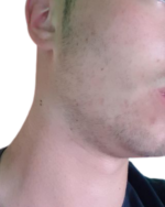 Minoxidil Dualgen 10%, 1 Luna Aplicare, Tratament pentru caderea parului si cresterea barbii - imagine 2