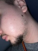 Minoxidil Member's Mark 5%, 1 Luna Aplicare, Tratament pentru caderea parului si cresterea barbii, 60 ml - imagine 3