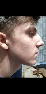 Minoxidil Dualgen 5% Absorbtie Rapida, fara PG, 1 Luna Aplicare, Tratament pentru caderea parului si cresterea barbii - imagine 3