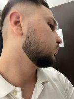 Minoxidil Member's Mark 5%, 1 Luna Aplicare, Tratament pentru caderea parului si cresterea barbii, 60 ml - imagine 4