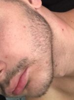 Minoxidil Rogaine 5%, 1 Luna Aplicare, Tratament pentru caderea parului si cresterea barbii - imagine 5