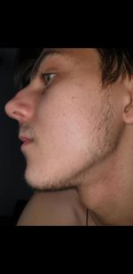 Minoxidil Dualgen 5% Absorbtie Rapida, fara PG, 1 Luna Aplicare, Tratament pentru caderea parului si cresterea barbii - imagine 4