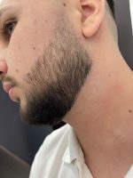 Minoxidil Member's Mark 5%, 1 Luna Aplicare, Tratament pentru caderea parului si cresterea barbii, 60 ml - imagine 5