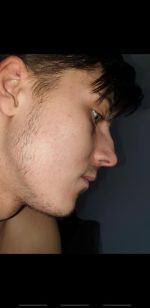 Minoxidil Dualgen 5% Absorbtie Rapida, fara PG, 1 Luna Aplicare, Tratament pentru caderea parului si cresterea barbii - imagine 5