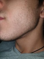 Minoxidil Dualgen 5% Absorbtie Rapida, fara PG, 1 Luna Aplicare, Tratament pentru caderea parului si cresterea barbii - imagine 6