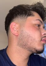 Minoxidil EssenGen 5%, Absorbtie Rapida, fara PG, 1-2 Luni Aplicare, Tratament pentru caderea parului si cresterea barbii, Unisex - imagine 6
