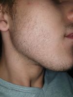 Minoxidil Dualgen 5% Absorbtie Rapida, fara PG, 1 Luna Aplicare, Tratament pentru caderea parului si cresterea barbii - imagine 7