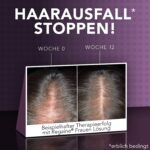Spuma, Minoxidil Regaine 5%, Tratament Impotriva Caderii Parului, Pentru Femei, 2x 60ml, 4 Luni Aplicare - imagine 2