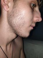 Minoxidil Dualgen 5% Absorbtie Rapida, fara PG, 1 Luna Aplicare, Tratament pentru caderea parului si cresterea barbii - imagine 9