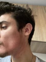 Minoxidil Foligain 5%, 1 Luna Aplicare, Tratament pentru caderea parului si cresterea barbii, Cantitate de Alcool Redusa, 60 ml - imagine 2