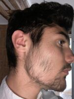 Minoxidil Foligain 5%, 1 Luna Aplicare, Tratament pentru caderea parului si cresterea barbii, Cantitate de Alcool Redusa, 60 ml - imagine 7