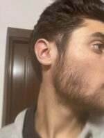 Minoxidil Foligain 5%, 1 Luna Aplicare, Tratament pentru caderea parului si cresterea barbii, Cantitate de Alcool Redusa, 60 ml - imagine 9