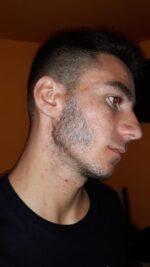 Rogaine 5% Minoxidil Spuma, 1 Luna Aplicare, Tratament pentru caderea parului si cresterea barbii, 60 ml - imagine 6