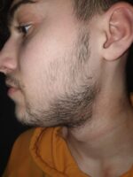 Minoxidil Foligain 5%, 1 Luna Aplicare, Tratament pentru caderea parului si cresterea barbii, 60 ml - imagine 4