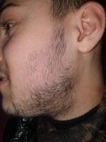 Minoxidil Foligain 5%, 1 Luna Aplicare, Tratament pentru caderea parului si cresterea barbii, 60 ml - imagine 5