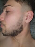 Minoxidil Foligain 5%, 1 Luna Aplicare, Tratament pentru caderea parului si cresterea barbii, 60 ml - imagine 6