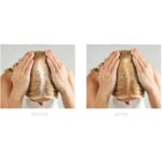 Spuma, Minoxidil Foligain 2%, 3 Luni Aplicare, Now Biotin 1000 mcg, 100 Capsule, Tratament Impotriva Caderii Parului La Femei - imagine 2