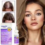 Minoxidil Equate 2% + Dermaroller, Pentru Femei, 1 Luna Aplicare, Tratament Impotriva Caderii Parului, Pipeta Inclusa - imagine 2