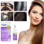 Minoxidil Equate 2% + Dermaroller, Pentru Femei, 1 Luna Aplicare, Tratament Impotriva Caderii Parului, Pipeta Inclusa - imagine 3