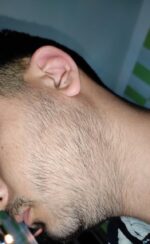 Spuma, Minoxidil Equate 5%, 1 Luna Aplicare, Tratament pentru caderea parului si cresterea barbii - imagine 4