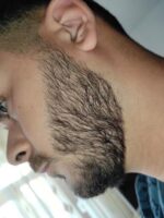 Spuma, Minoxidil Equate 5%, 1 Luna Aplicare, Tratament pentru caderea parului si cresterea barbii - imagine 5