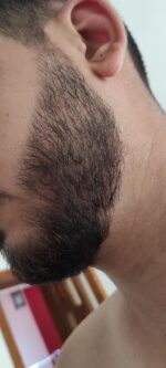 Spuma, Minoxidil Equate 5%, 1 Luna Aplicare, Tratament pentru caderea parului si cresterea barbii - imagine 6
