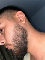 Spuma, Minoxidil Equate 5%, 1 Luna Aplicare, Tratament pentru caderea parului si cresterea barbii - imagine 7