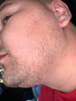 Minoxidil Equate 5%, 1 Luna Aplicare, Tratament pentru caderea parului si cresterea barbii - imagine 2