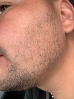 Minoxidil Equate 5%, 1 Luna Aplicare, Tratament pentru caderea parului si cresterea barbii - imagine 3