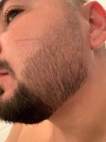 Minoxidil Equate 5%, 1 Luna Aplicare, Tratament pentru caderea parului si cresterea barbii - imagine 4