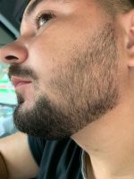 Minoxidil Equate 5%, 1 Luna Aplicare, Tratament pentru caderea parului si cresterea barbii - imagine 5