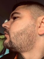 Minoxidil Equate 5%, 1 Luna Aplicare, Tratament pentru caderea parului si cresterea barbii - imagine 6