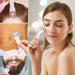 Dermaroller pentru Mezoterapie cu Lumina LED – 540 Ace, 3 Capete Înlocuibile pentru Cresterea Parului si a Barbii - imagine 8