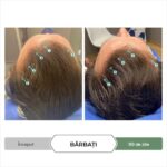 Sampon Antioxidant pentru cresterea parului  – Tratament Avansat pentru Densitatea Parului, Calmare si Revitalizare a Scalpului, cu CBD, Impotriva Caderii Parului cauzate de DHT, Fara Sulfati si Parabeni, pentru Barbati si Femei, 205 mL, DS Labs Revita CBD - imagine 15