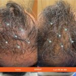 Sampon – Impotriva caderii parului,Tratament de Inalta Performanta pentru Densitatea Parului, Volumizare si Fortifiere, Par Mai Des si Mai Sanatos, Fara Sulfati si Silicon, Pentru Barbati si Femei, 205mL, DS Labs Revita - imagine 11
