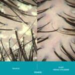 Sampon Exfoliant Antimatreata – Tratament Dermatologic Impotriva Dermatitei Seboreice, Psoriazisului si Matretii Cronice, cu Acid Salicilic 2%, Carbune Activ si Ingrediente Clinice pentru Calmarea Scalpului, Reducerea Pruritului si Descumarii, Formula Imbunatatita pentru Utilizare Zilnica, 205 ml, DS LABS Dandrene - imagine 7