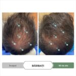Sampon Antioxidant pentru cresterea parului  – Tratament Avansat pentru Densitatea Parului, Calmare si Revitalizare a Scalpului, cu CBD, Impotriva Caderii Parului cauzate de DHT, Fara Sulfati si Parabeni, pentru Barbati si Femei, 205 mL, DS Labs Revita CBD - imagine 12