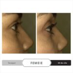 Spectral.LASH Ser Tratament pentru Cresterea Genelor – Formula Oftalmologica, Hipoalergenica si Vegana, Fara Ulei, Parabeni sau Gluten, Compatibila cu Extensiile de Gene, Aplicare Precisa, Pentru Gene Mai Lungi si Mai Dese, Unisex, 2.4 ml - imagine 10