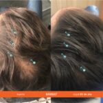 Sampon – Impotriva caderii parului,Tratament de Inalta Performanta pentru Densitatea Parului, Volumizare si Fortifiere, Par Mai Des si Mai Sanatos, Fara Sulfati si Silicon, Pentru Barbati si Femei, 205mL, DS Labs Revita - imagine 14