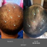 Sampon cu Nanoxidil – Impotriva caderii parului, Tratament Intens pentru Densitate Capilara, Fortifiere si Volum, Par Vizibil Mai Des si Mai Rezistent, Fara Sulfati si Silicon, Pentru Barbati si Femei, 205mL, DS Labs Revita Extra Strength - imagine 10
