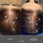 Sampon cu Nanoxidil – Impotriva caderii parului, Tratament Intens pentru Densitate Capilara, Fortifiere si Volum, Par Vizibil Mai Des si Mai Rezistent, Fara Sulfati si Silicon, Pentru Barbati si Femei, 205mL, DS Labs Revita Extra Strength - imagine 11