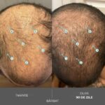 Sampon cu Nanoxidil – Impotriva caderii parului, Tratament Intens pentru Densitate Capilara, Fortifiere si Volum, Par Vizibil Mai Des si Mai Rezistent, Fara Sulfati si Silicon, Pentru Barbati si Femei, 205mL, DS Labs Revita Extra Strength - imagine 12