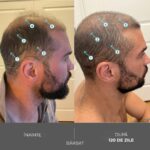 Sampon – pentru alopecie androgenetica, Tratament Impotriva Caderii Parului, Cu Nanoxidil, Tripeptide de Cupru si Serenoa Serrulata, Fortifiant si Hidratant, Pentru Toate Tipurile de Par, Unisex, 210 ml, DS Labs Polaris NR-02® - imagine 5