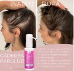 Spray pentru Cresterea Parului la Femei, Remixidil, Minoxidil 2%, 1 luna aplicare, 60 ml - imagine 6
