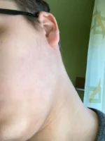 Spuma, Member’s Mark, Minoxidil 5%, 4 Luni Aplicare, Tratament Impotriva Caderii Parului, pentru Barbati, fara Parfum, 4×60 ml - imagine 2