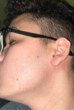 Spuma, Member’s Mark, Minoxidil 5%, 4 Luni Aplicare, Tratament Impotriva Caderii Parului, pentru Barbati, fara Parfum, 4×60 ml - imagine 3