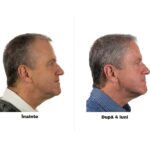 FOLIGAIN Formula Completa cu Actiune Tripla pentru Par cu Tendinta de Rarire la Barbati – 10% TRIOXIDIL - imagine 7